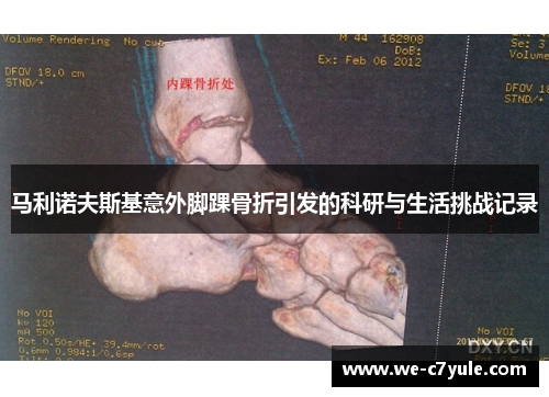 马利诺夫斯基意外脚踝骨折引发的科研与生活挑战记录